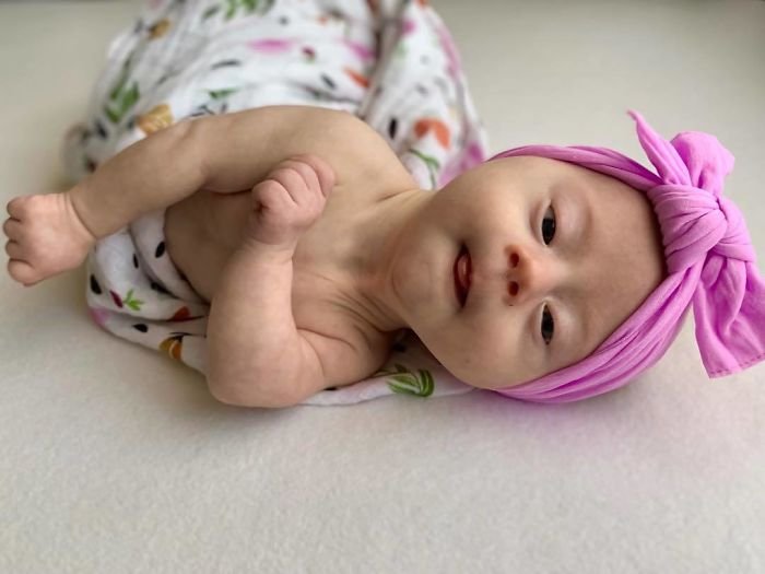 1583258197 622 Mae compartilha sua “visao” honesta de seu bebe com sindrome