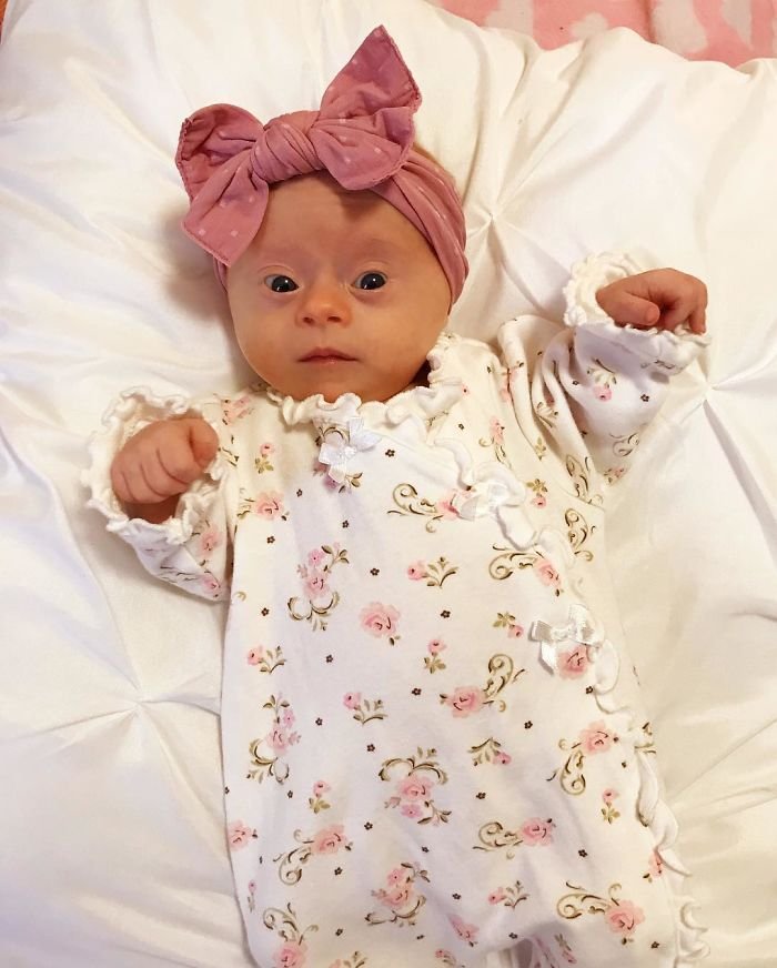 1583258194 289 Mae compartilha sua “visao” honesta de seu bebe com sindrome