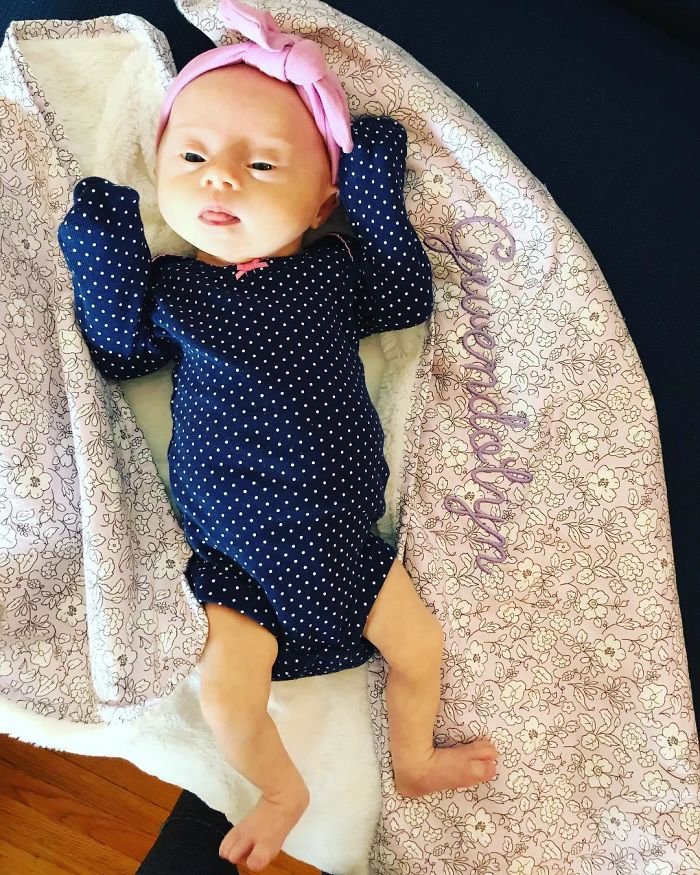 1583258190 169 Mae compartilha sua “visao” honesta de seu bebe com sindrome