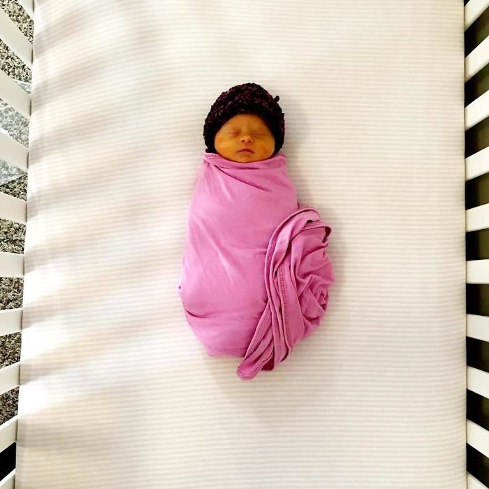1583258194 978 Mae compartilha sua “visao” honesta de seu bebe com sindrome