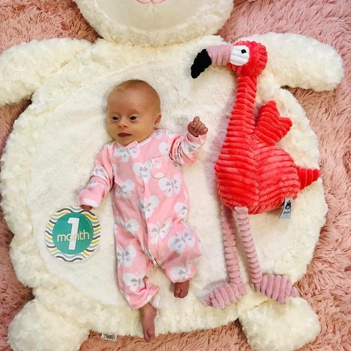 1583258191 32 Mae compartilha sua “visao” honesta de seu bebe com sindrome