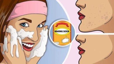 surpreendente mascara de vinagre de maca e bicarbonato para eliminar acne e manchas coisas de vo