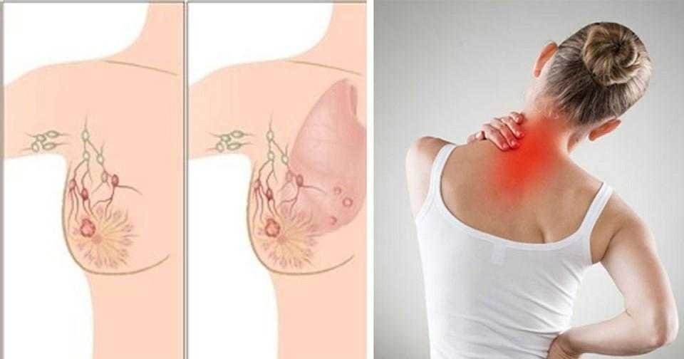 5 Sinais de câncer da mama que quase todos ignoram