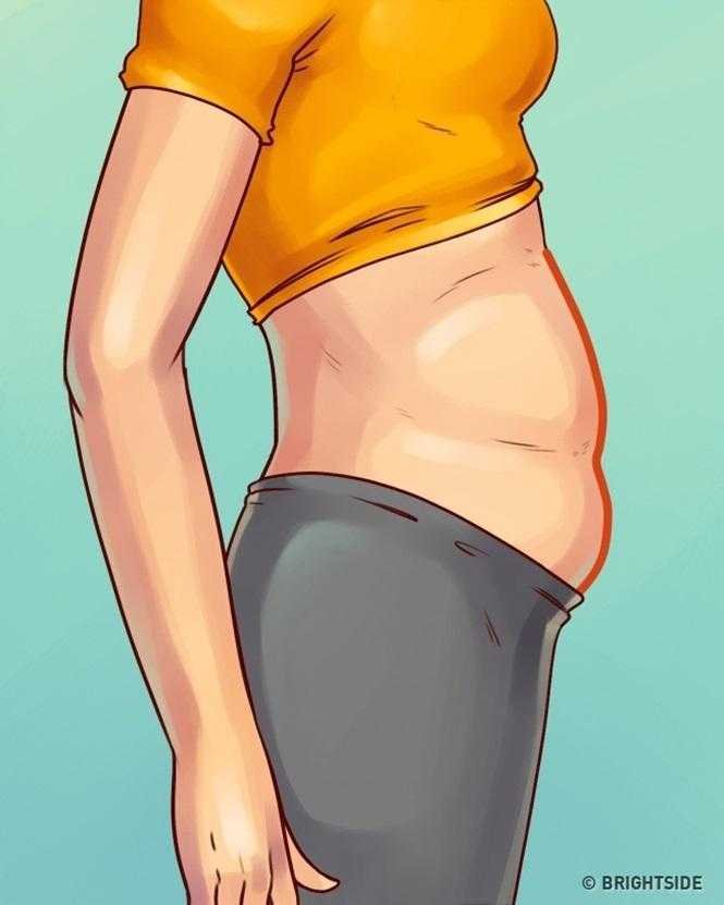5 tipos de barriga que não são causados pelo excesso de peso d