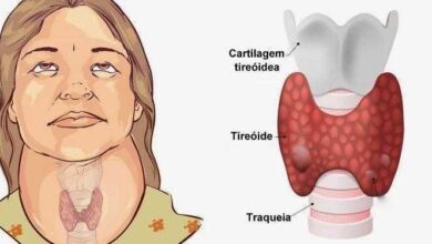 8 sinais que podem revelar problema na tireoide