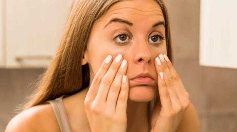 Aprenda como eliminar as olheiras naturalmente