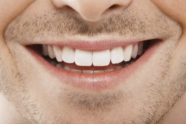 1495159730 325 elimine o tartaro e clareie seus dentes usando apenas esse remedio caseiro