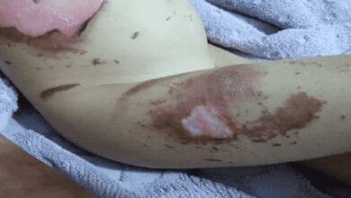 Isso é o que acontece com o seu corpo, se você comer 2 bananas com manchas escuras todo dia, por 1 mês. Confira…