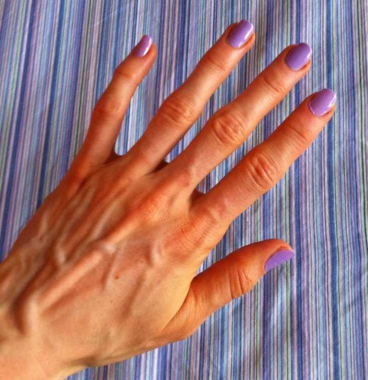 Saiba por que algumas pessoas têm as veias das mãos marcadas