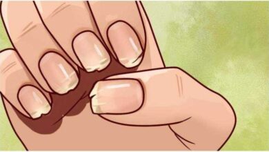 Suas unhas estão frágeis e quebradiças? Isto é o que seu corpo está tentando te advertir