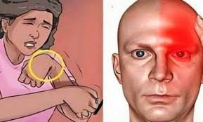 Bebê de 17 dias contrai herpes após beijo de visita