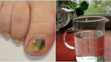 Água oxigenada para prevenir fungos das unhas