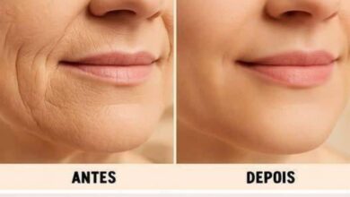 Botox Caseiro: Tira Rugas e Bigode Chinês