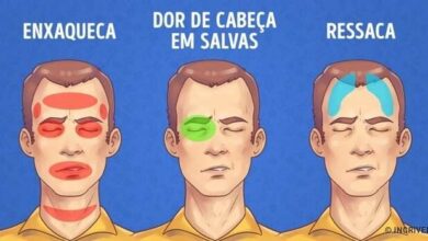 Como aliviar rapidamente 5 tipos de dores de cabeça
