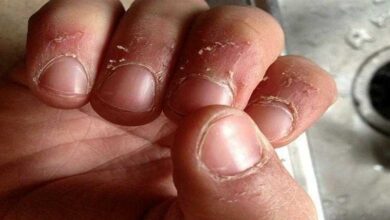 Como prevenir e curar cutículas naturalmente