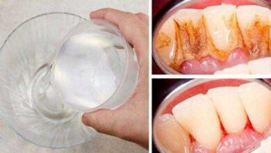 Elimine a placa bacteriana-tártaro e ainda clareia os dentes 1