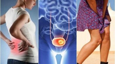 7 sinais de câncer de bexiga aos quais devemos ficar atentos 1q