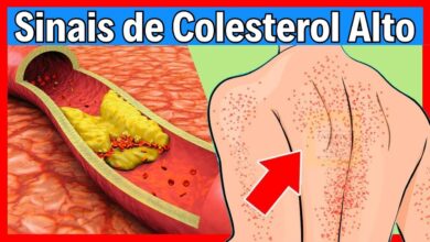 Sinais de Colesterol Alto Que Você Não Deve Ignorar