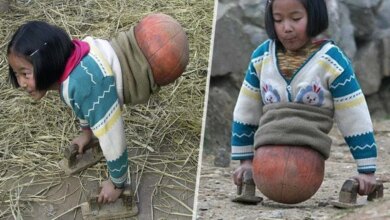 Se você acha que sua vida é ruim, veja esta história inspiradora sobre a garota “Basquete”